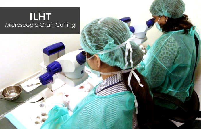 Microscopic Graft Cutting