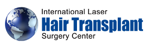 International Laser Hair Transplant Surgery Center
